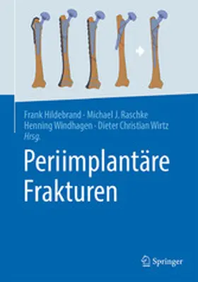 Hildebrand / Raschke / Windhagen |  Periimplantäre Frakturen | eBook | Sack Fachmedien