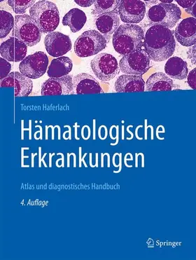 Haferlach |  Hämatologische Erkrankungen | Buch |  Sack Fachmedien