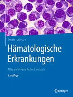 Haferlach |  Hämatologische Erkrankungen | eBook | Sack Fachmedien