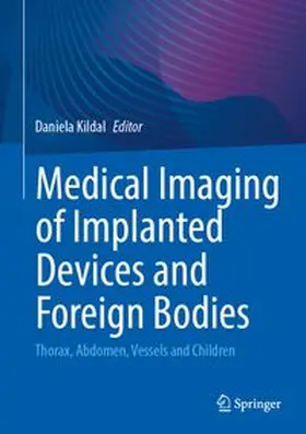 Kildal |  Medical Imaging of Implanted Devices and Foreign Bodies | eBook | Sack Fachmedien