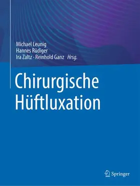 Leunig / Rüdiger / Zaltz |  Chirurgische Hüftluxation | Buch |  Sack Fachmedien
