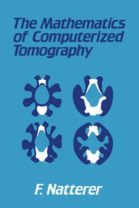 Natterer | The Mathematics of Computerized Tomography | E-Book | www.sack.de