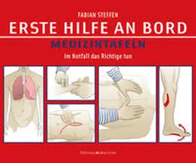 Steffen |  Erste Hilfe an Bord – Medizintafeln | Buch |  Sack Fachmedien