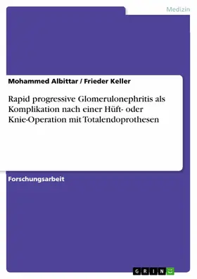 Albittar / Keller |  Rapid progressive Glomerulonephritis als Komplikation nach einer Hüft- oder Knie-Operation mit Totalendoprothesen | eBook | Sack Fachmedien