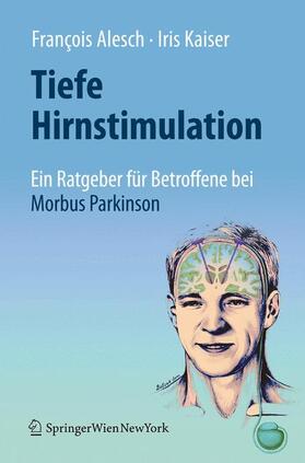 Kaiser / Alesch | Tiefe Hirnstimulation: Ein Ratgeber für Betroffene bei Morbus Parkinson | Buch | 978-3-7091-0253-4 | sack.de