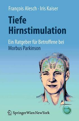 Alesch / Kaiser | Tiefe Hirnstimulation: Ein Ratgeber für Betroffene bei Morbus Parkinson | E-Book | sack.de