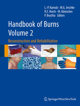 Kamolz / Jeschke / Horch | Handbook of Burns Volume 2 | E-Book | sack.de