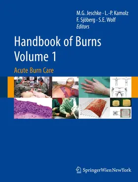 Jeschke / Kamolz / Herndon | Handbook of Burns Volume 1 | Buch | 978-3-7091-0347-0 | sack.de