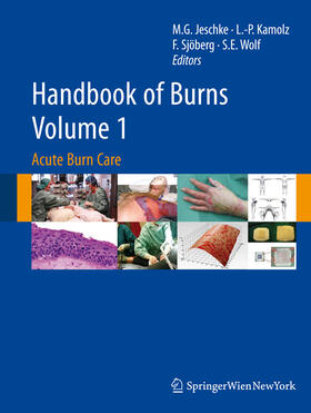 Jeschke / Kamolz / Sjöberg | Handbook of Burns Volume 1 | E-Book | sack.de