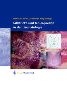 Köhn / Ring |  Fallstricke und Fehlerquellen in der Dermatologie | eBook | Sack Fachmedien
