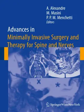 Alexandre / Menchetti / Masini |  Advances in Minimally Invasive Surgery and Therapy for Spine and Nerves | Buch |  Sack Fachmedien