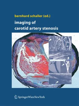 Schaller | Imaging of Carotid Artery Stenosis | Buch | 978-3-7091-1741-5 | www.sack.de