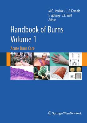 Jeschke / Wolf / Kamolz | Handbook of Burns Volume 1 | Buch | 978-3-7091-1918-1 | sack.de