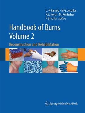 Kamolz / Jeschke / Brychta | Handbook of Burns Volume 2 | Buch | 978-3-7091-1921-1 | sack.de