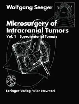 Seeger |  Microsurgery of Intracranial Tumors | eBook | Sack Fachmedien
