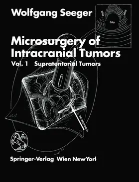 Seeger |  Microsurgery of Intracranial Tumors | Buch |  Sack Fachmedien