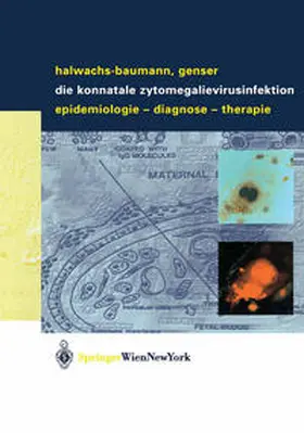 Halwachs-Baumann / Genser |  Die konnatale Zytomegalievirusinfektion | eBook | Sack Fachmedien