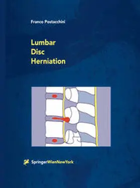 Postacchini | Lumbar Disc Herniation | E-Book | www.sack.de