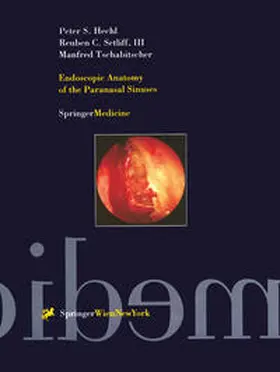 Hechl / Setliff / Tschabitscher |  Endoscopic Anatomy of the Paranasal Sinuses | eBook | Sack Fachmedien