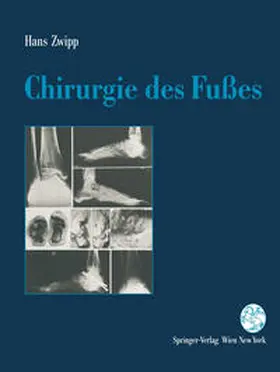 Zwipp | Chirurgie des Fußes | E-Book | sack.de