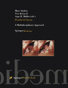 Sindou / Keravel / Møller | Hemifacial Spasm | E-Book | sack.de