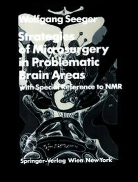 Seeger |  Strategies of Microsurgery in Problematic Brain Areas | eBook | Sack Fachmedien