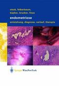 Steck / Felberbaum / Finas |  Endometriose | Buch |  Sack Fachmedien