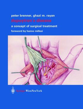Brenner / Rayan | Dupuytren's Disease | Buch | 978-3-7091-7274-2 | sack.de