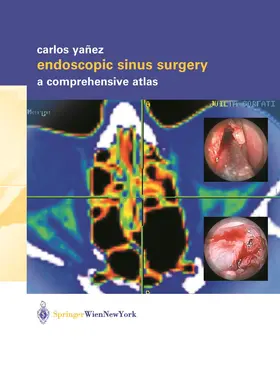 Yañez |  Endoscopic Sinus Surgery | Buch |  Sack Fachmedien