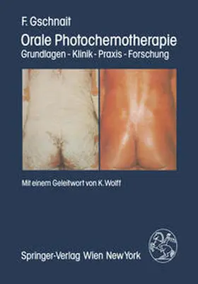 Gschnait |  Orale Photochemotherapie | eBook | Sack Fachmedien