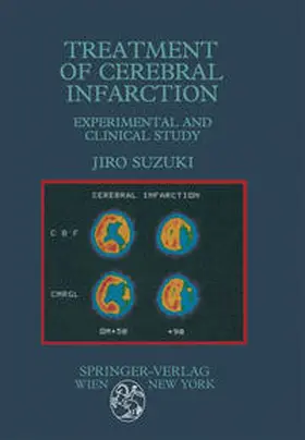 Suzuki |  Treatment of Cerebral Infarction | eBook | Sack Fachmedien