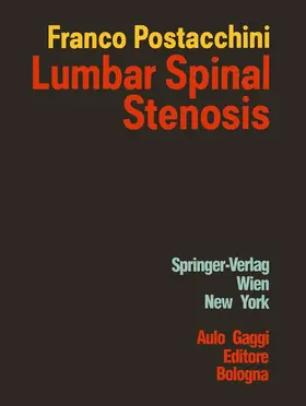 Postacchini |  Lumbar Spinal Stenosis | Buch |  Sack Fachmedien