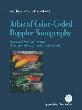 Frühwald / Blackwell |  Atlas of Color-Coded Doppler Sonography | Buch |  Sack Fachmedien