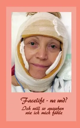 Fischer / Siegmund | Facelift - na und? | Buch | 978-3-7322-3815-6 | www.sack.de