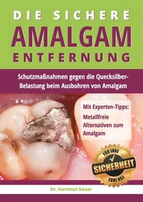 Sauer |  Die sichere Amalgam-Entfernung | Buch |  Sack Fachmedien