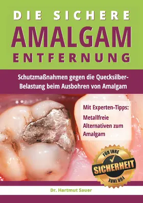 Sauer |  Die sichere Amalgam-Entfernung | eBook | Sack Fachmedien