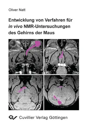 Natt |  Entwicklung von Verfahren für in vivo NMR-Untersuchungen des Gehirns der Maus | eBook | Sack Fachmedien