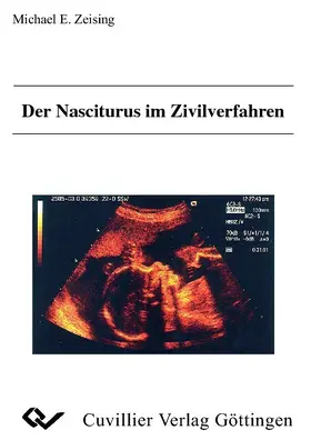 Zeising |  Der Nasciturus im Zivilverfahren | eBook | Sack Fachmedien