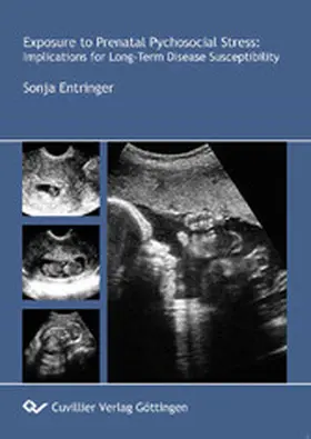 Entringer |  Exposure to Prenatal Psychosocial Stress: | eBook | Sack Fachmedien