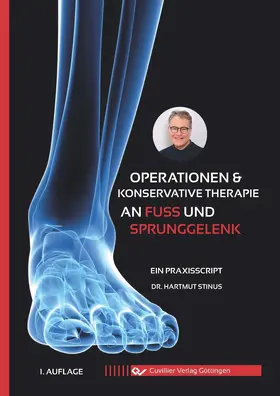 Stinus |  Operationen & konservative Therapie an Fuß und Sprunggelenk | eBook | Sack Fachmedien