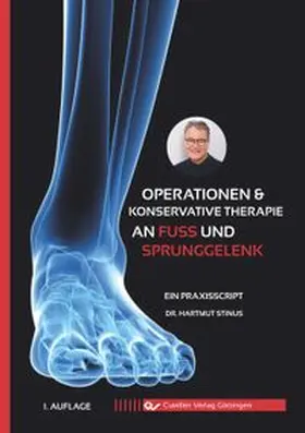 Stinus |  Operationen & konservative Therapie an Fuß und Sprunggelenk | Buch |  Sack Fachmedien