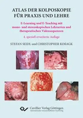 Koßagk / Seidl |  Atlas der Kolposkopie für Praxis und Lehre. E-Learning und E-Teaching mit mono- und stereoskopischen Lehrserien und therapeutischen Videosequenzen | Buch |  Sack Fachmedien