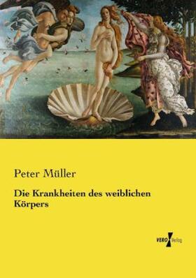 Müller |  Die Krankheiten des weiblichen Körpers | Buch |  Sack Fachmedien