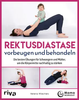 Wiechers | Rektusdiastase vorbeugen und behandeln | Buch | 978-3-7423-2497-9 | sack.de
