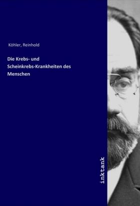 Köhler | Die Krebs- und Scheinkrebs-Krankheiten des Menschen | Buch | 978-3-7477-8778-6 | sack.de
