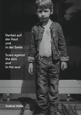Holtz |  Narben auf der Haut und in der Seele | Buch |  Sack Fachmedien