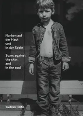 Holtz |  Narben auf der Haut und in der Seele | eBook | Sack Fachmedien