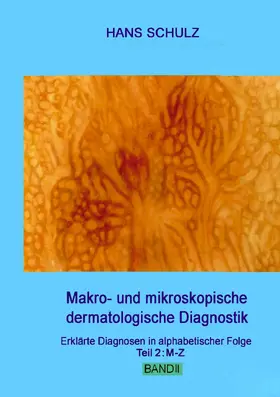 Schulz |  Makro- und mikroskopische dermatologische Diagnostik Band 2 | eBook | Sack Fachmedien
