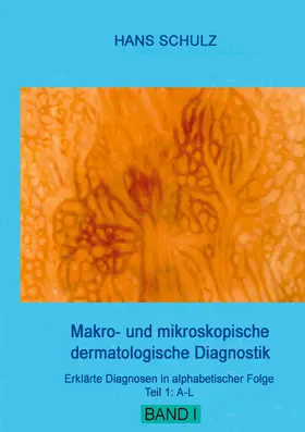 Schulz |  Makro- und mikroskopische dermatologische Diagnostik | eBook | Sack Fachmedien