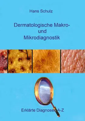 Schulz |  Dermatologische Makro- und Mikrodiagnostik | eBook | Sack Fachmedien